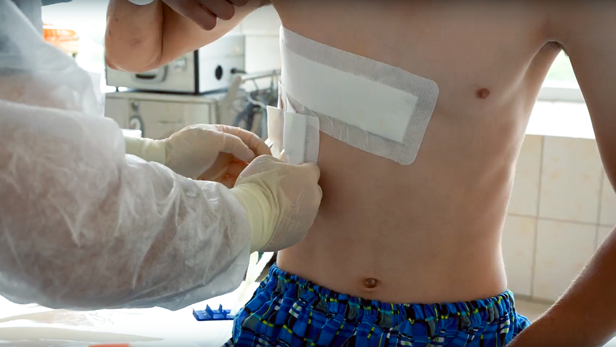 В Склифе спасли пациента, упавшего на арматуру, которая проткнула его тело насквозь В Склифе спасли пациента, упавшего на арматуру, которая проткнула его тело насквозь