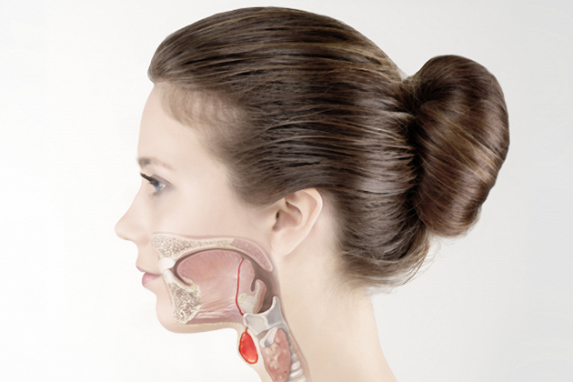 Удаление срединной кисты шеи