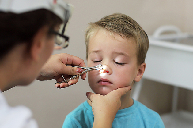 Аденоиды у детей: удалять или оставлять?