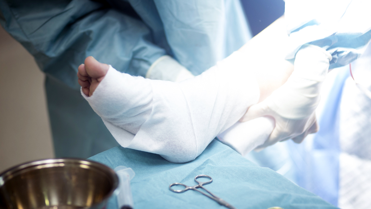 Операция при болезни Тейлора.