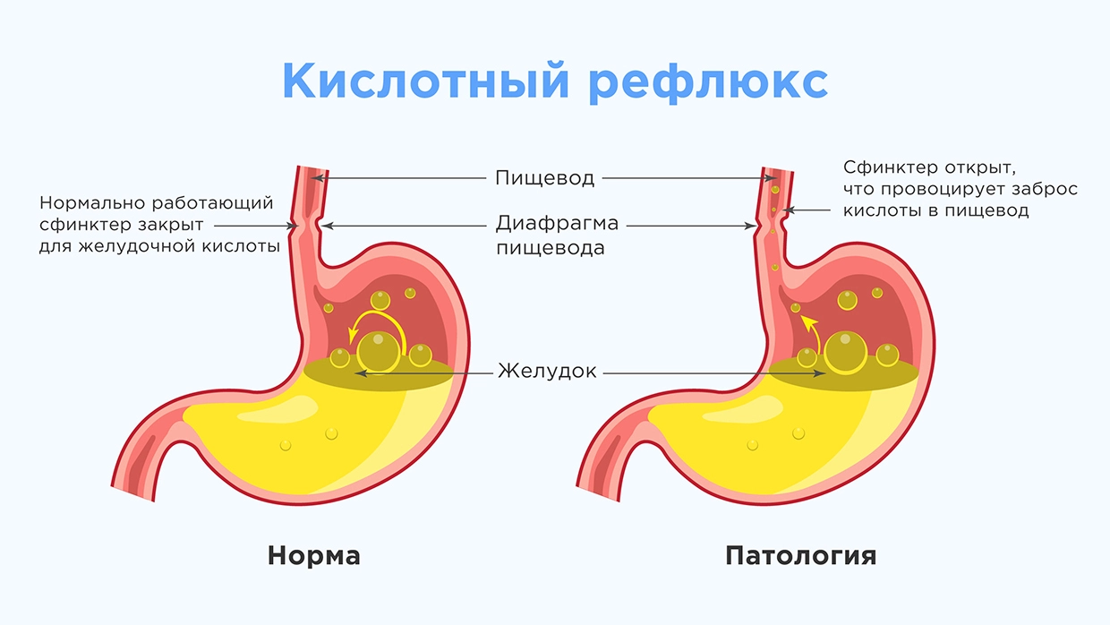 Содержание жкт