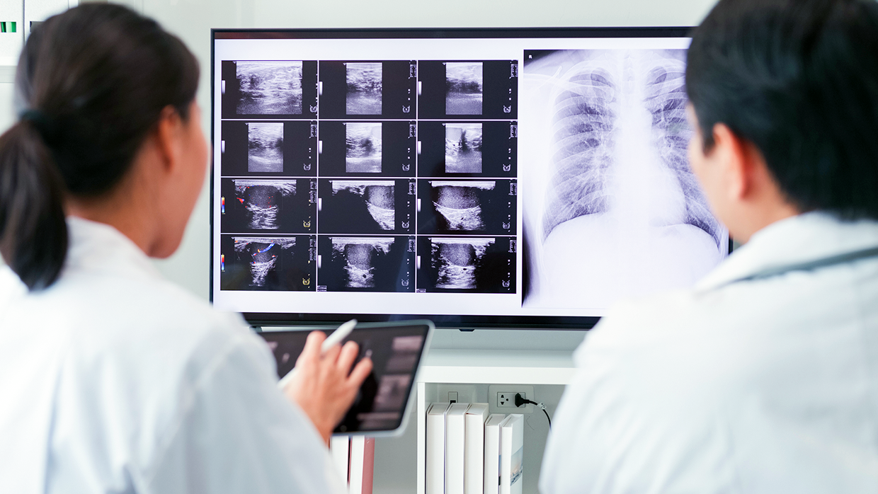 Рентген и компьютерная томография грудной клетки ребенка.